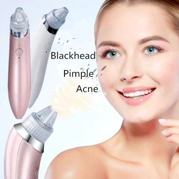 Kemei Blackhead Sucker Machine